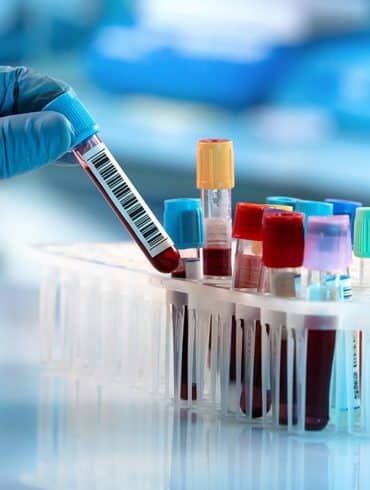 medical-lab-tests